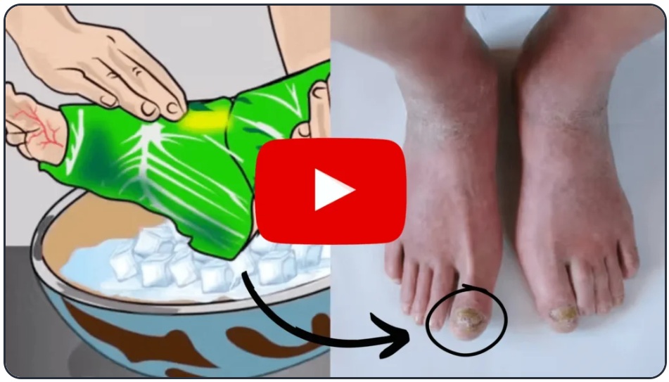 fungus hack