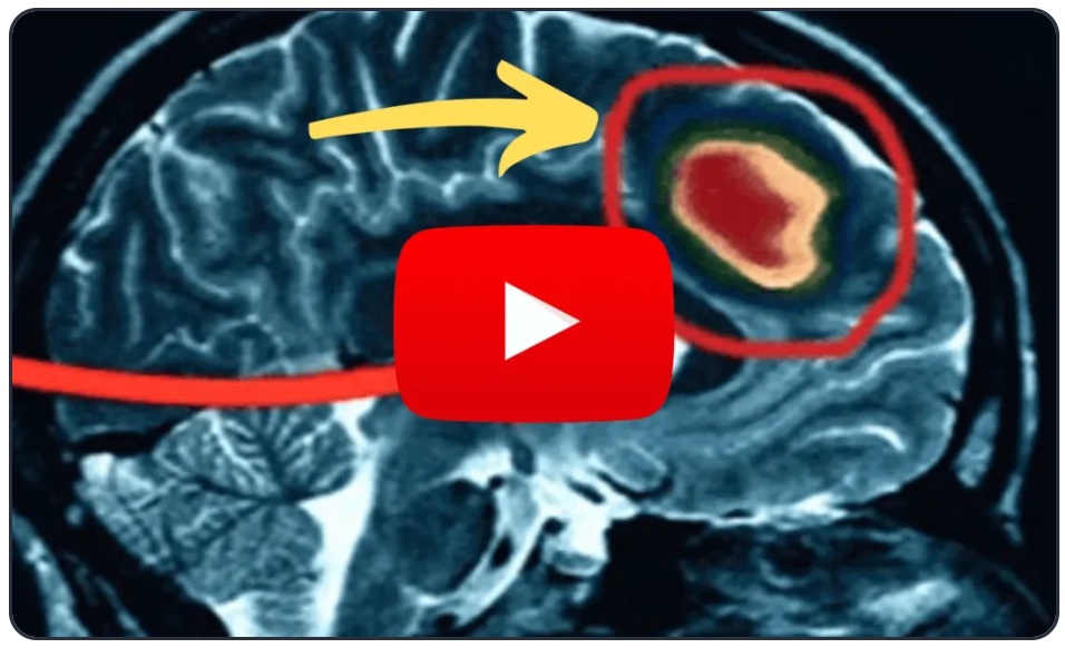 tinnitus_cure